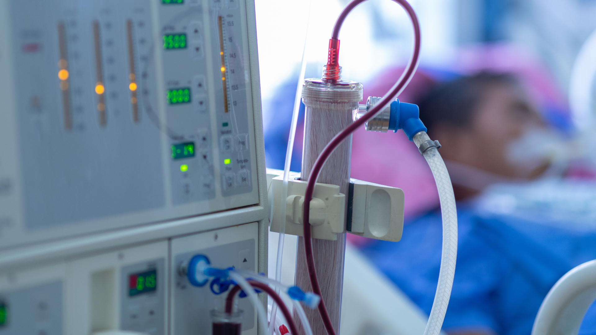 Medical equipment in a hospital intensive care unit showing dialysis or blood filtration tubing and monitoring devices, with a patient visible in the blurred background receiving treatment.