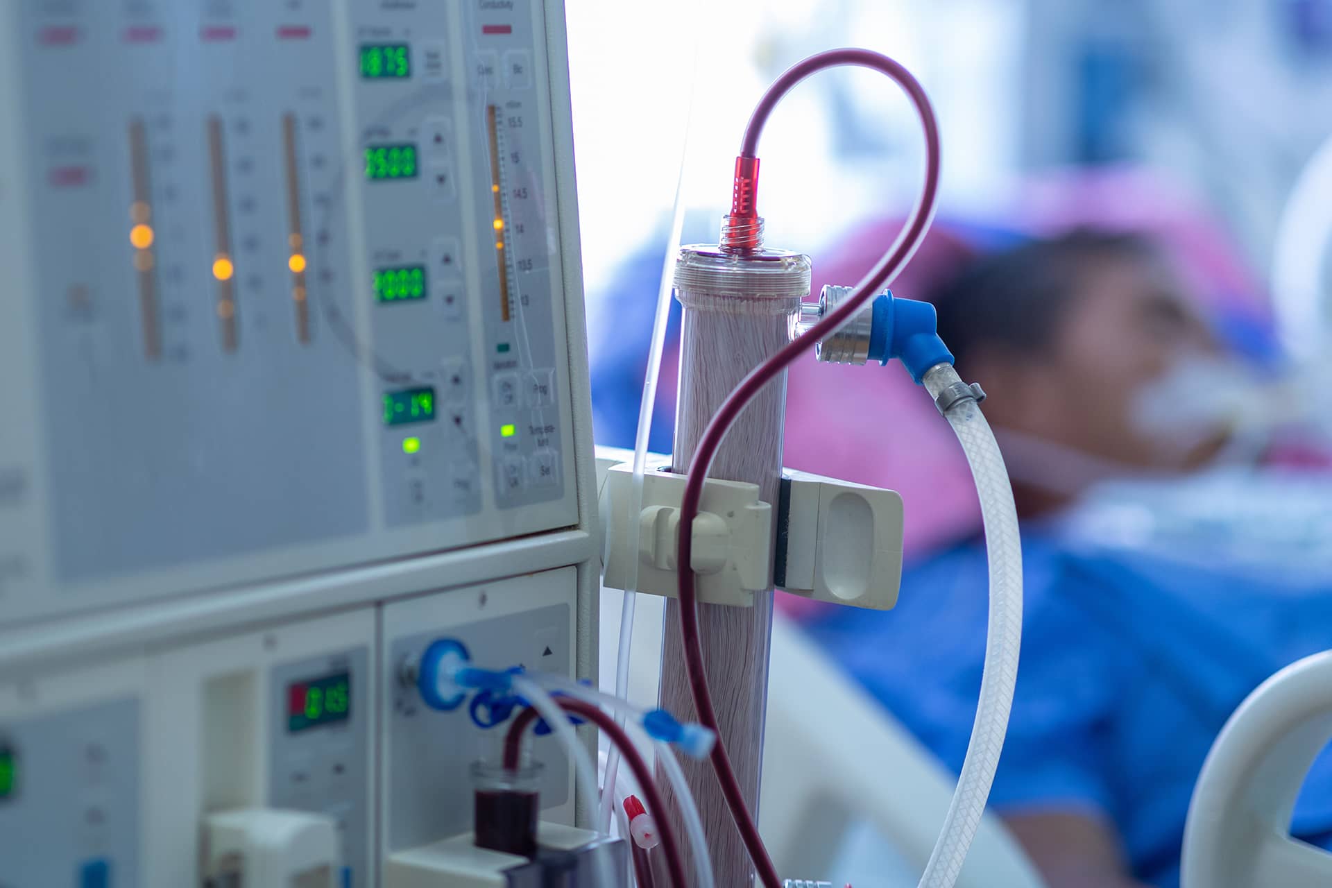 Medical equipment showing dialysis machine with tubing and monitoring displays in a hospital treatment room, with a patient visible but blurred in the background.